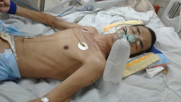 Hưng Yên: Sang hàng xóm, bị đánh nhập viện trong tình trạng nguy kịch