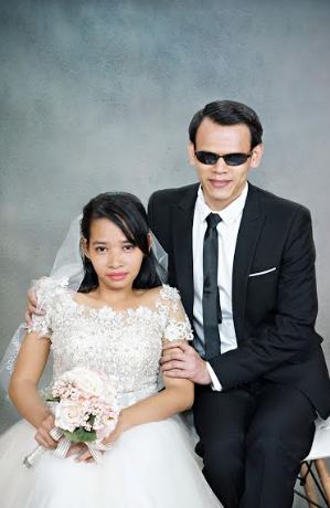 Bộ ảnh cưới giản dị, đầy xúc động của 15 cặp đôi khuyết tật