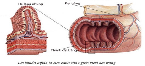 Sử dụng nhiều rượu bia khiến đại tràng bị 'tàn phá' nghiêm trọng