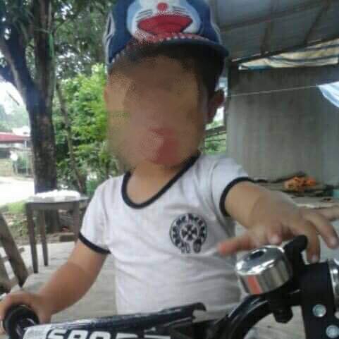 Yên Bái: Bé trai 5 tuổi tử vong sau khi cắt Amidan