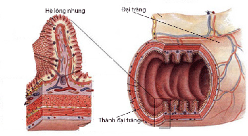 'Cứu cánh' cho người viêm đại tràng nhờ sáng chế của người Nhật