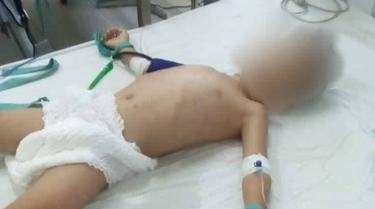 Bé trai 5 tuổi bị người tình của mẹ bạo hành đến hôn mê, nguy kịch