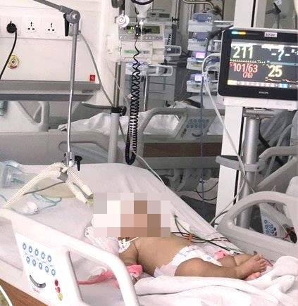 Bé gái 14 tháng tuổi bị khỉ tấn công, chấn thương sọ não