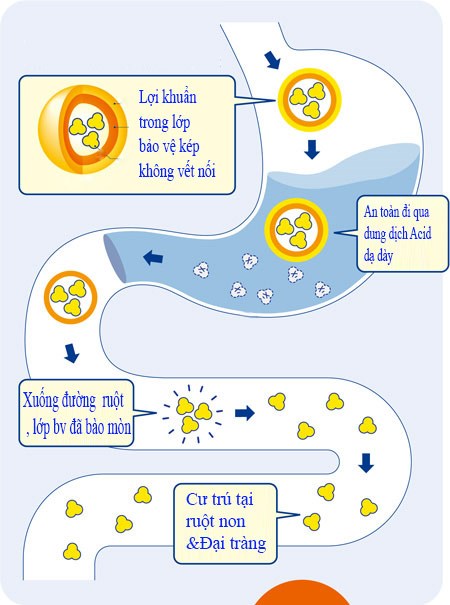 Cách người Nhật 'xử lý' bệnh viêm đại tràng