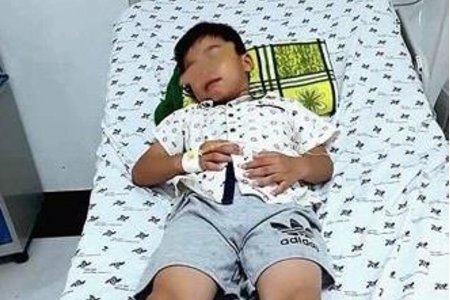 TP.HCM: Ngậm kẹo ngủ quên, bé trai 7 tuổi nuốt que nhựa dài 7,5cm vào bụng