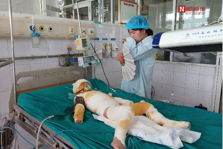 Vụ 3 trẻ mầm non bị bỏng cồn nặng ở Hà Nam: Tiết học kỹ năng sống nằm trong chương trình của Bộ