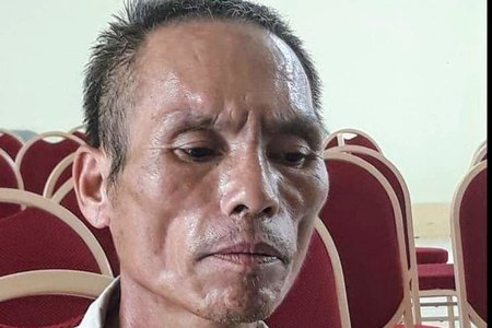 Nguyên nhân bé trai bị bác chém lìa tay ở Bắc Giang