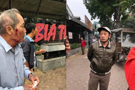 Cụ ông 80 tuổi ở Hà Nội bị gã xe ôm đánh, bắn súng cao su vào mặt
