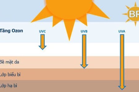 Bác sĩ chỉ cách bảo vệ cơ thể khi tia UV ở ngưỡng cao