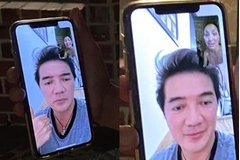 Ca sĩ Hồng Ngọc lộ gương mặt bị bỏng nặng qua màn hình facetime cùng Đàm Vĩnh Hưng