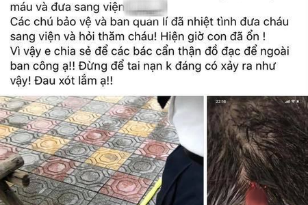 Hà Nội: Bé trai nhập viện vì bị chổi lau nhà từ tầng cao rơi trúng đầu