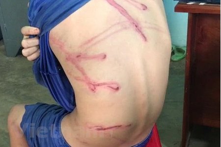 Nguyên nhân bé trai 12 tuổi bị bố dùng dây điện đánh dã man ở Bình Phước