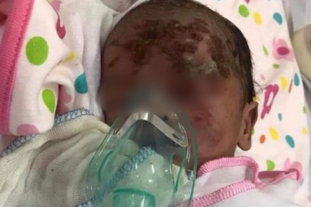 Yên Bái: Phát hiện bé trai sơ sinh bị bỏ rơi ven đường với nhiều vết xước trên mặt