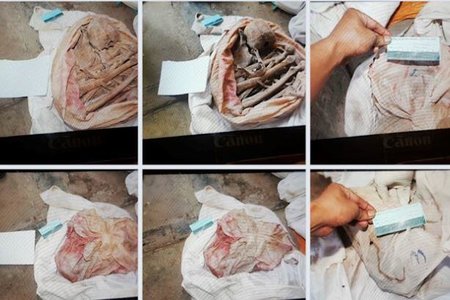 Phát hiện thêm 7 bộ xương người trong vườn cao su ở Tây Ninh