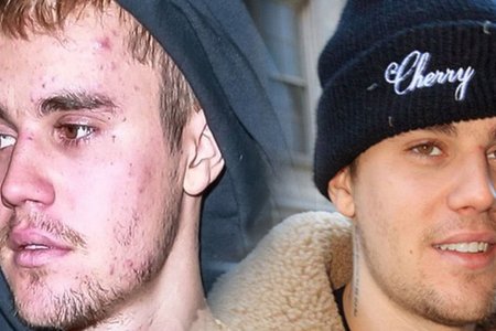 Justin Bieber tiết lộ cùng lúc anh bị mắc hai căn bệnh vô cùng đáng sợ