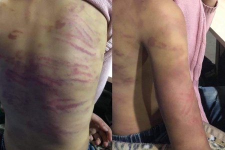 Hà Nội: Bé gái 12 tuổi nghi bị mẹ đẻ và người tình bạo hành