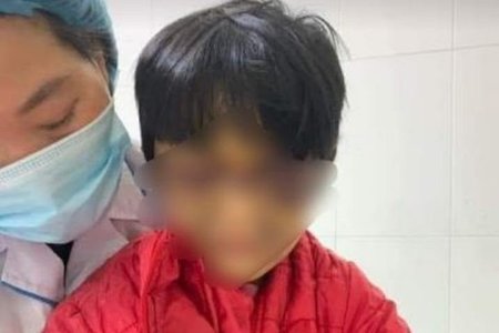 Hải Dương: Bé gái 6 tuổi bị mẹ đẻ bạo hành thâm tím mặt