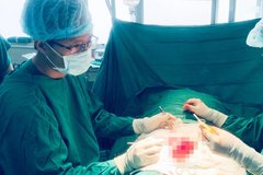 Mâu thuẫn tình cảm, vợ dùng kéo cắt đứt 'của quý' của chồng lúc ngủ say