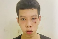 Hà Nội: Bắt giữ đối tượng cướp tiền lương hưu của cụ bà 70 tuổi