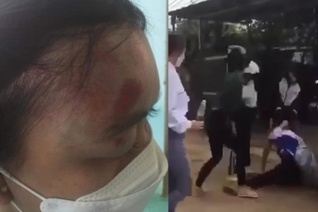 Nữ sinh lớp 11 bị nhóm người đánh hội đồng dã man trước cổng trường