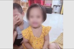 Vụ bé gái 3 tuổi nghi bị bắn đinh vào đầu: Tình nhân của người mẹ là nghi phạm