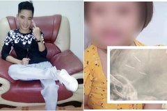 Vụ bé 3 tuổi bị găm 9 đinh vào đầu: Lạnh người những trận đòn roi của gã người tình