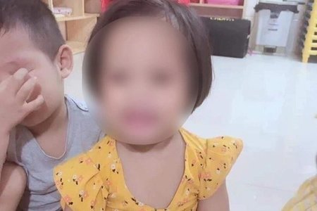 Vụ bé gái 3 tuổi bị ghim đinh vào đầu ở Hà Nội: Nạn nhân đã có phản xạ tay chân