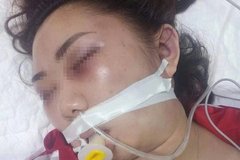 Cô gái 22 tuổi tử vong, nghi bị bạn trai đánh
