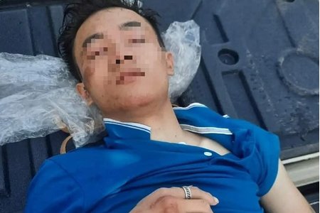 Nghệ An: Nam thanh niên câm điếc nghi bị đánh dập não ở nghĩa trang