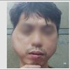 Thanh niên tố bị chủ quán lẩu nướng ở Hà Nội đánh biến dạng khuôn mặt