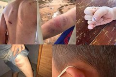 Khởi tố cha và bà nội bạo hành cháu bé 9 tuổi ở Đắk Lắk