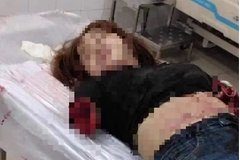 Đồng Nai: Người đàn ông dùng dao chém đửt lìa 2 cánh tay vợ