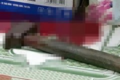 Nam nhân viên dùng búa tấn công con gái chủ quán vì bị từ chối tình cảm