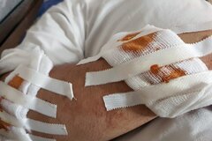 Điều tra nhóm đối tượng chém người đi đường lúc rạng sáng ở Hà Nội