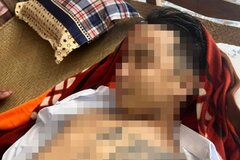Điều tra vụ nam thanh niên nghi bị bắn tử vong ở Long An