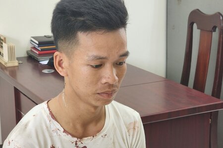 Đà Nẵng: Nam thanh niên chém gục người yêu rồi có ý định tự tử