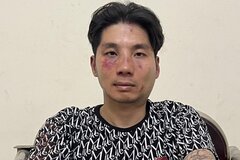 Bắt đối tượng cầm dao vào quán cướp tiền, đâm bị thương trung tá công an