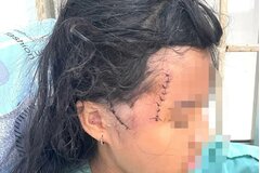 Đồng Nai: Tạm giữ 'chồng hờ' chém mẹ con người tình bị thương