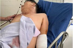 Điều tra vụ tài xế xe tải bị chém nhập viện ở Đà Nẵng