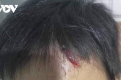 Điều tra vụ bé trai 10 tuổi nghi bị mẹ kế tiếp tục bạo hành ở Cà Mau