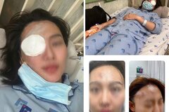 Khởi tố nam thanh niên đánh bạn gái dã man trong quán cà phê