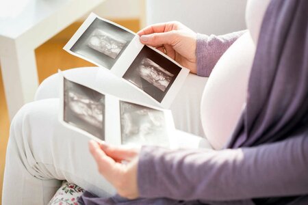 Bộ Y tế đề xuất phạt đến 100 triệu đồng nếu lựa chọn giới tính thai nhi
