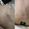 Điều tra vụ bé gái 4 tuổi bị giáo viên mầm non đánh đập, kéo lê, ném vào tường ở Hà Nội