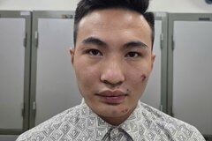 Tạm giữ nam thanh niên vi phạm giao thông, chống người thi hành công vụ