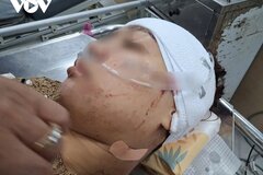 Điều tra vụ nữ cán bộ xã dùng dao rọc giấy rạch mặt 'tình địch' ở Đồng Tháp