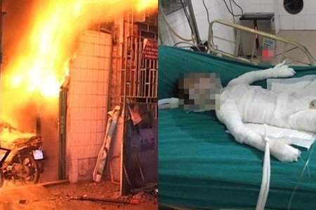 Vụ tẩm xăng đốt nhà bố vợ: Bé trai 6 tuổi bị bỏng nặng đã tử vong