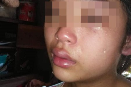 Bị chồng đánh liên tục, mẹ trẻ uất ức đăng Facebook cầu cứu