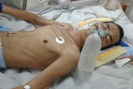 Hưng Yên: Sang hàng xóm, bị đánh nhập viện trong tình trạng nguy kịch