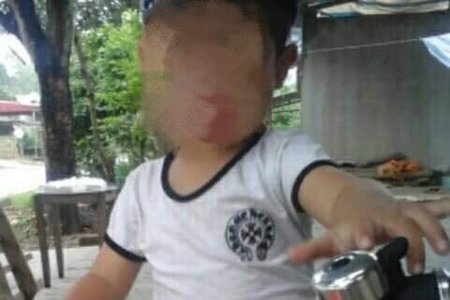 Yên Bái: Bé trai 5 tuổi tử vong sau khi cắt Amidan