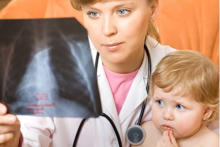 5 sự thật phũ phàng về bệnh viêm phổi ở trẻ nhỏ